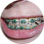 Orthdontics Dental Service Houston, TX