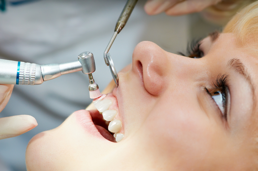 Routine Cleaning Dental Service Houston, TX