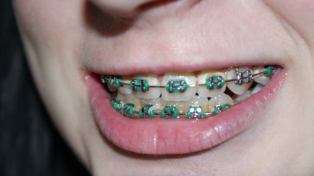 Orthodontics Dental Service Houston, TX
